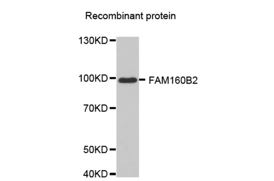 Western blot - FAM160B2 antibody from Signalway Antibody (38631) - Antibodies.com