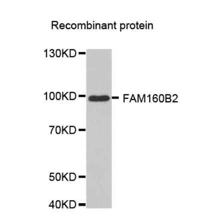 Western blot - FAM160B2 antibody from Signalway Antibody (38631) - Antibodies.com