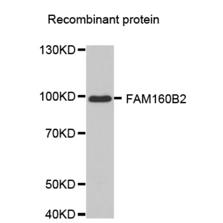 Western blot - FAM160B2 antibody from Signalway Antibody (38631) - Antibodies.com