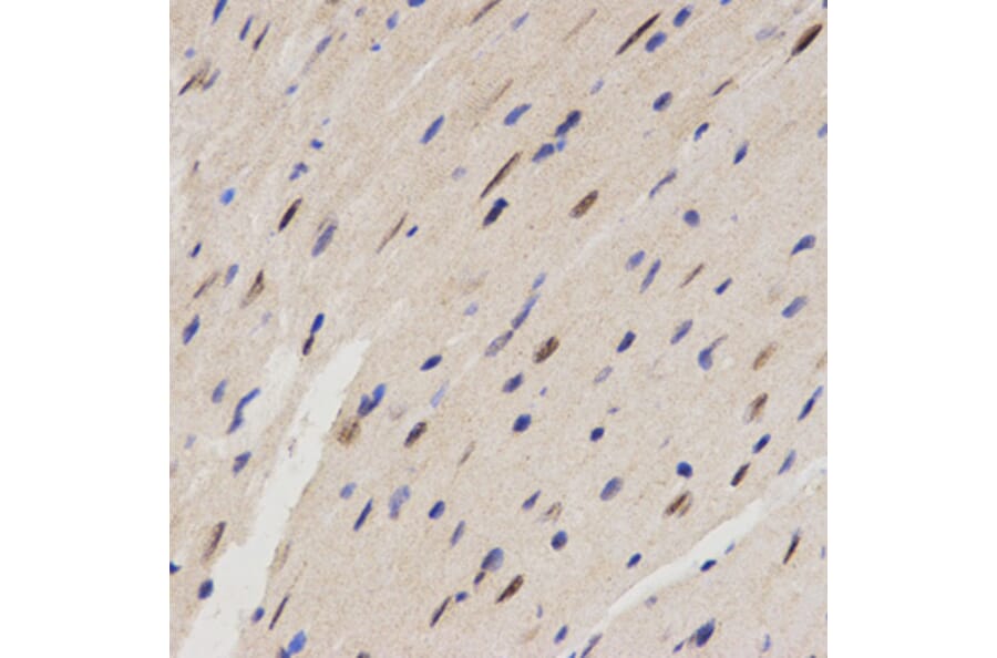 Immunohistochemistry - FAM160B2 antibody from Signalway Antibody (38631) - Antibodies.com