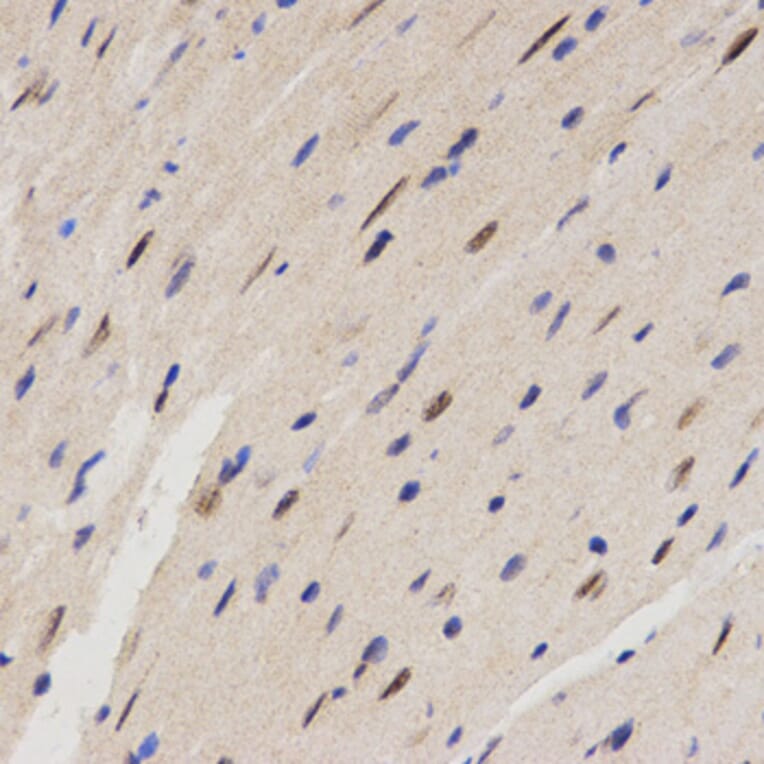Immunohistochemistry - FAM160B2 antibody from Signalway Antibody (38631) - Antibodies.com