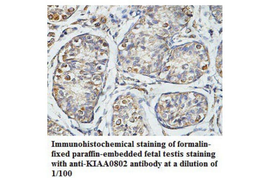 KIAA0802 Antibody from Signalway Antibody (39785) - Antibodies.com