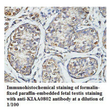 KIAA0802 Antibody from Signalway Antibody (39785) - Antibodies.com