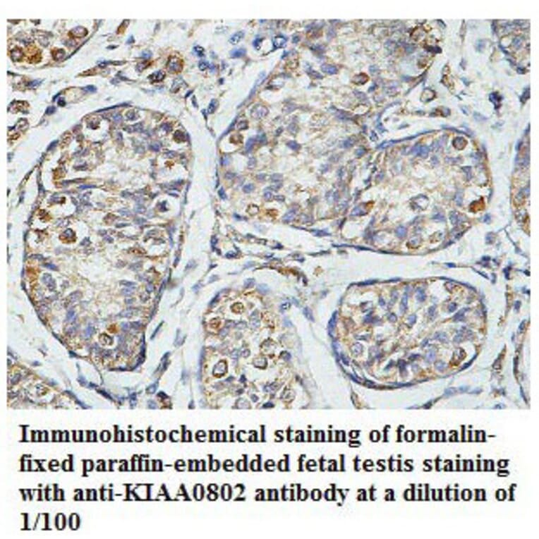 KIAA0802 Antibody from Signalway Antibody (39785) - Antibodies.com