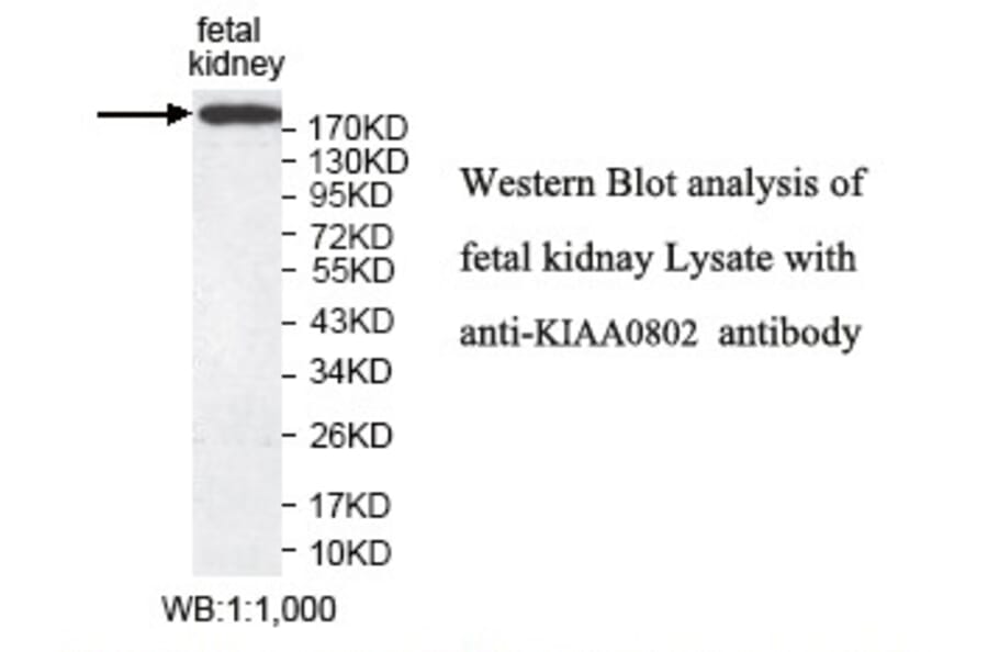 KIAA0802 Antibody from Signalway Antibody (39785) - Antibodies.com