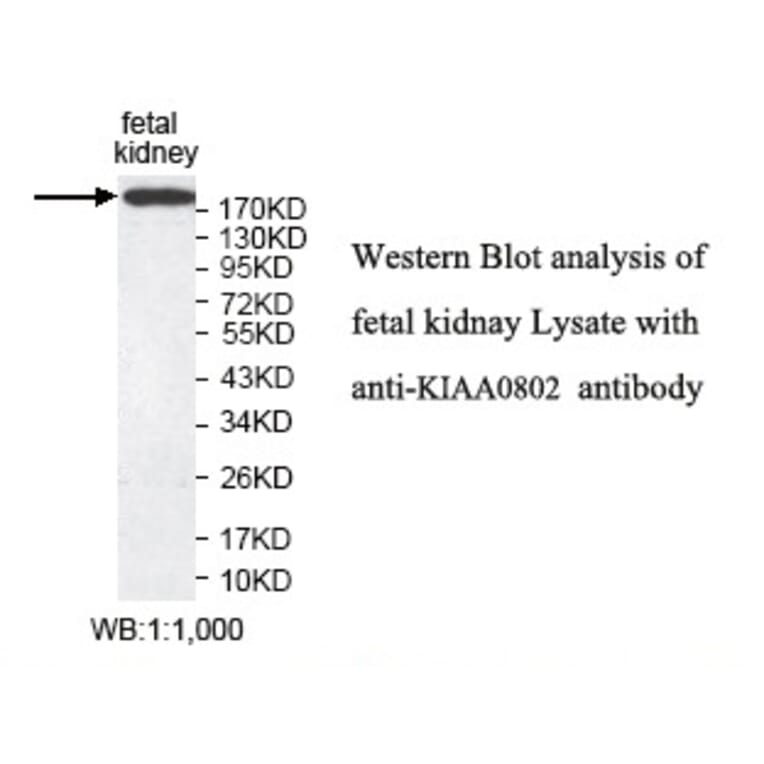 KIAA0802 Antibody from Signalway Antibody (39785) - Antibodies.com