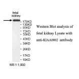 KIAA0802 Antibody from Signalway Antibody (39785) - Antibodies.com