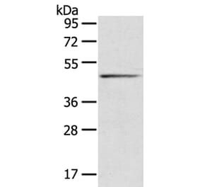 SERPINB8 Antibody from Signalway Antibody (40101) - Antibodies.com