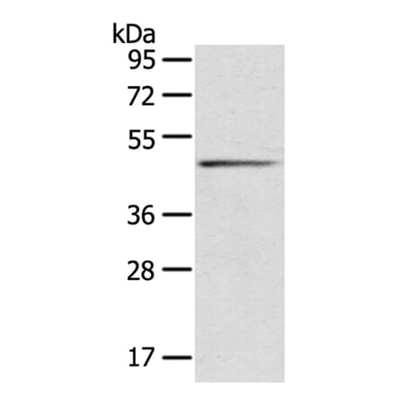 SERPINB8 Antibody from Signalway Antibody (40101) - Antibodies.com