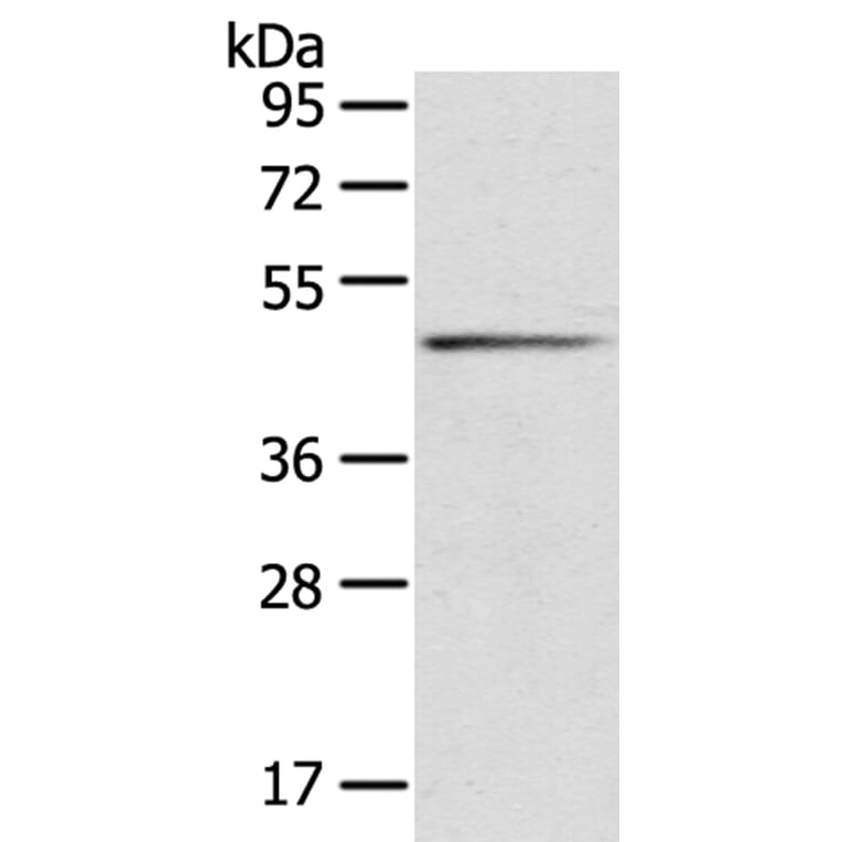 SERPINB8 Antibody from Signalway Antibody (40101) - Antibodies.com