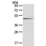 SERPINB8 Antibody from Signalway Antibody (40101) - Antibodies.com