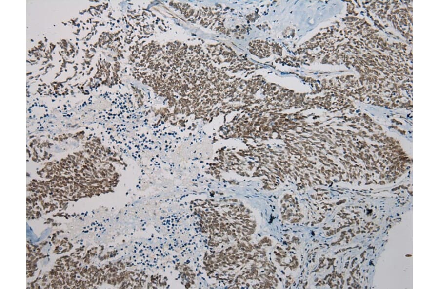 Immunohistochemistry - SERPINB8 Antibody from Signalway Antibody (40101) - Antibodies.com