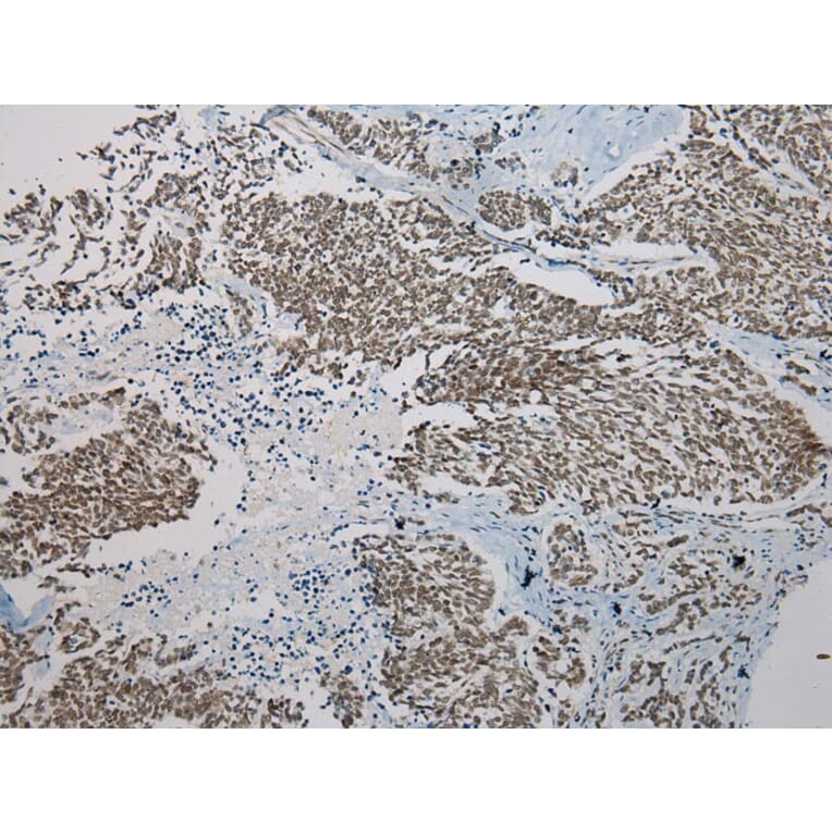 Immunohistochemistry - SERPINB8 Antibody from Signalway Antibody (40101) - Antibodies.com