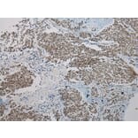 Immunohistochemistry - SERPINB8 Antibody from Signalway Antibody (40101) - Antibodies.com