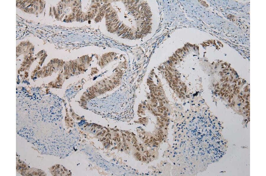 Immunohistochemistry - SERPINB8 Antibody from Signalway Antibody (40101) - Antibodies.com