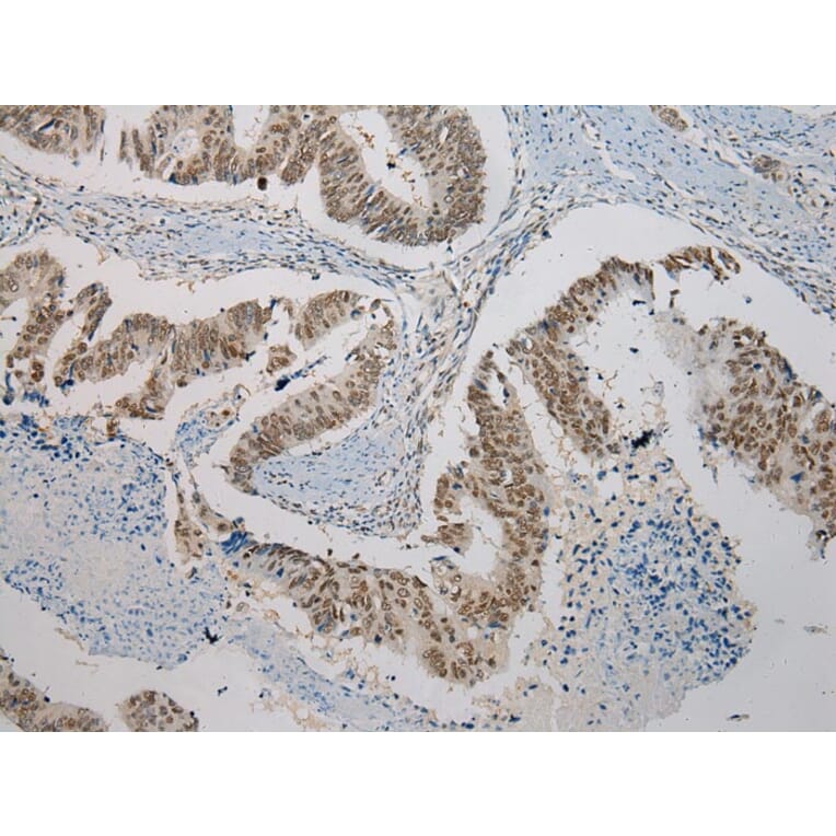 Immunohistochemistry - SERPINB8 Antibody from Signalway Antibody (40101) - Antibodies.com