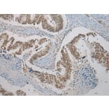 Immunohistochemistry - SERPINB8 Antibody from Signalway Antibody (40101) - Antibodies.com