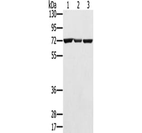 SLC25A13 Antibody from Signalway Antibody (42757) - Antibodies.com