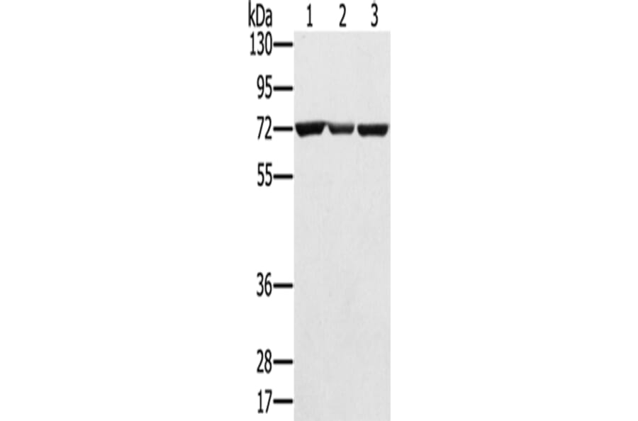 SLC25A13 Antibody from Signalway Antibody (42757) - Antibodies.com