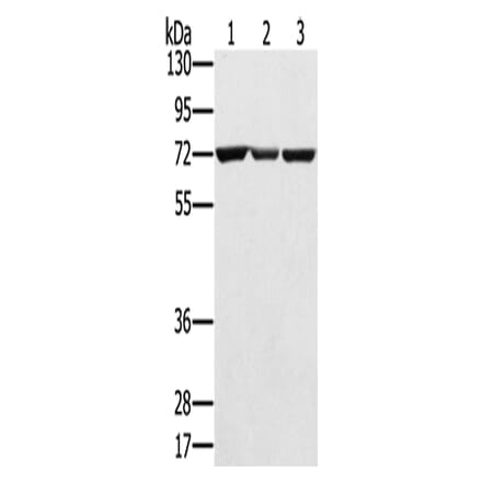 SLC25A13 Antibody from Signalway Antibody (42757) - Antibodies.com