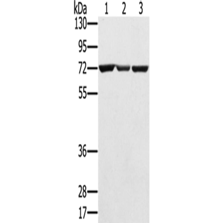 SLC25A13 Antibody from Signalway Antibody (42757) - Antibodies.com