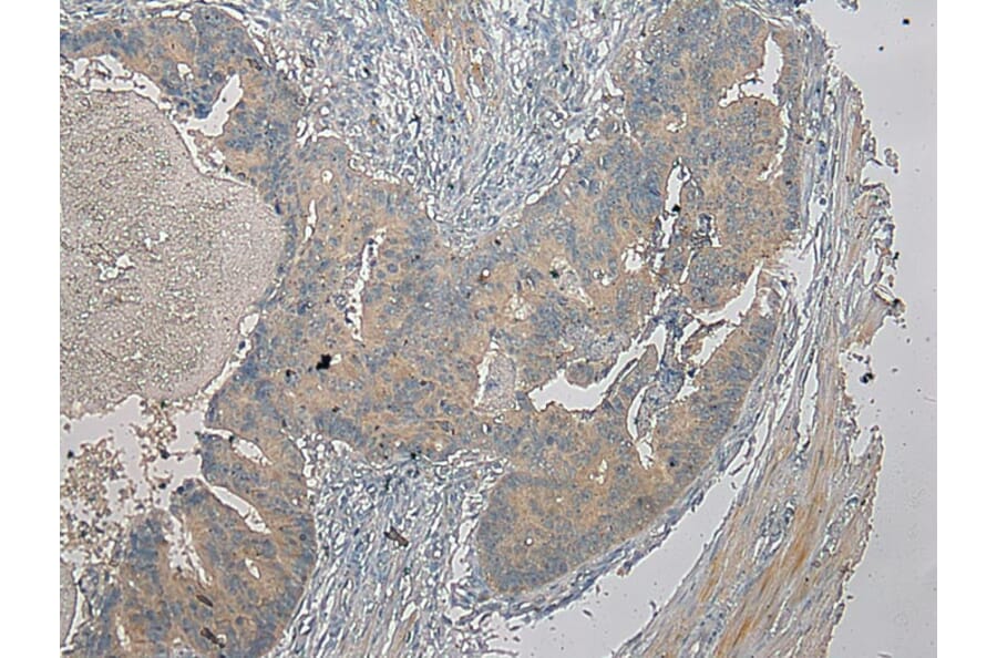Immunohistochemistry - SLC25A13 Antibody from Signalway Antibody (42757) - Antibodies.com