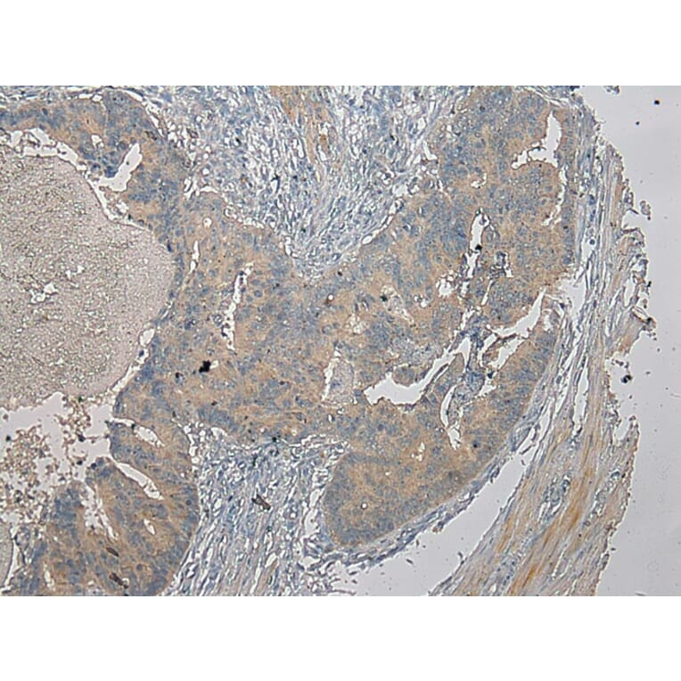 Immunohistochemistry - SLC25A13 Antibody from Signalway Antibody (42757) - Antibodies.com