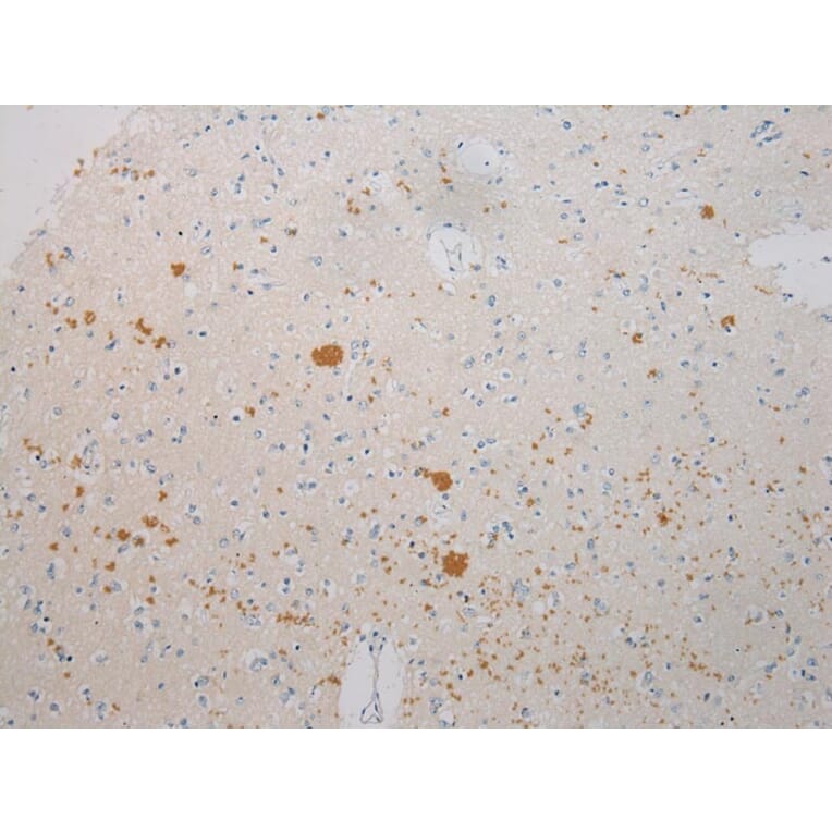 Immunohistochemistry - SLC25A13 Antibody from Signalway Antibody (42757) - Antibodies.com