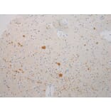 Immunohistochemistry - SLC25A13 Antibody from Signalway Antibody (42757) - Antibodies.com