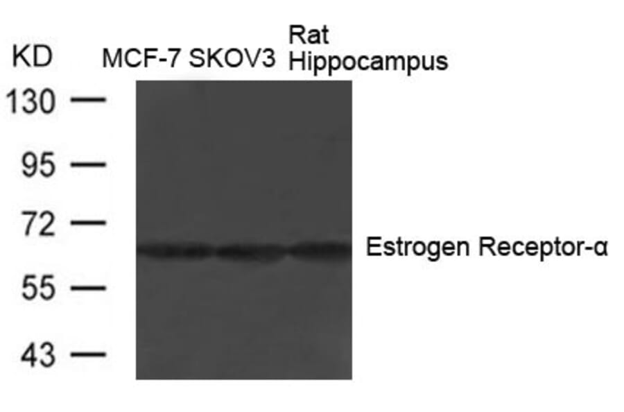 Western blot - Estrogen Receptor-a (Ab-104) Antibody from Signalway Antibody (21065) - Antibodies.com