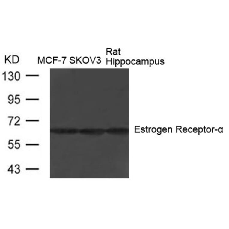 Western blot - Estrogen Receptor-a (Ab-104) Antibody from Signalway Antibody (21065) - Antibodies.com