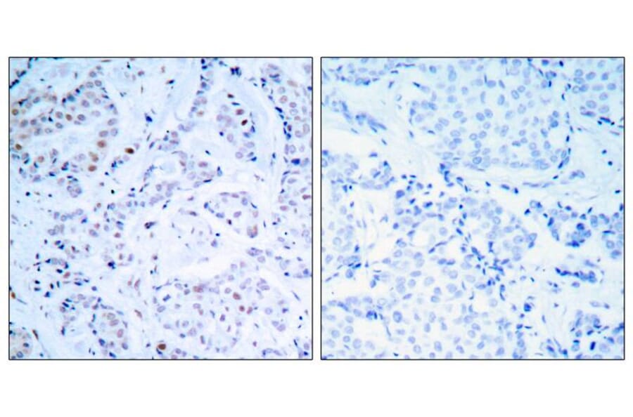 Immunohistochemistry - Estrogen Receptor-a (Ab-104) Antibody from Signalway Antibody (21065) - Antibodies.com