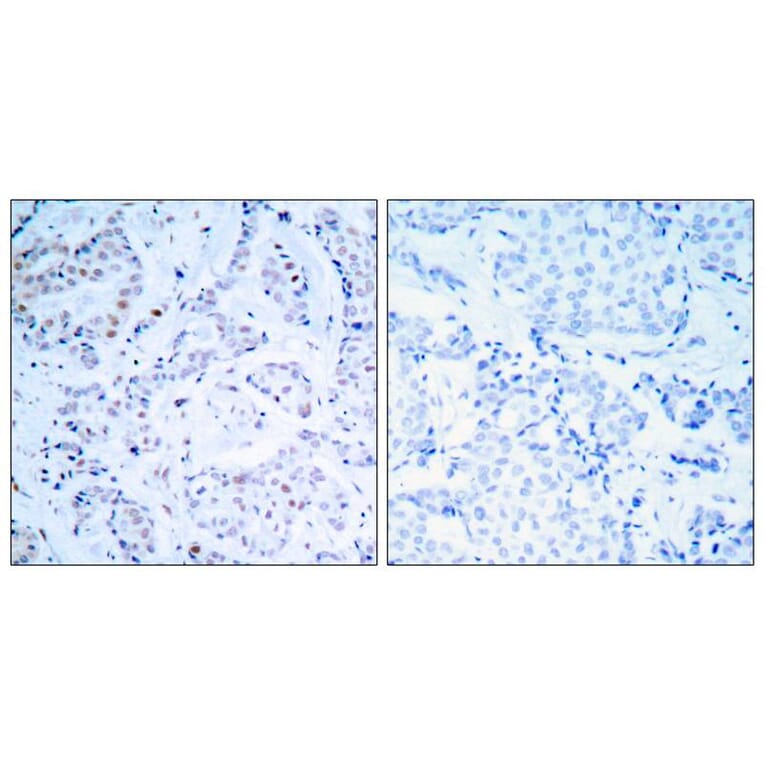 Immunohistochemistry - Estrogen Receptor-a (Ab-104) Antibody from Signalway Antibody (21065) - Antibodies.com