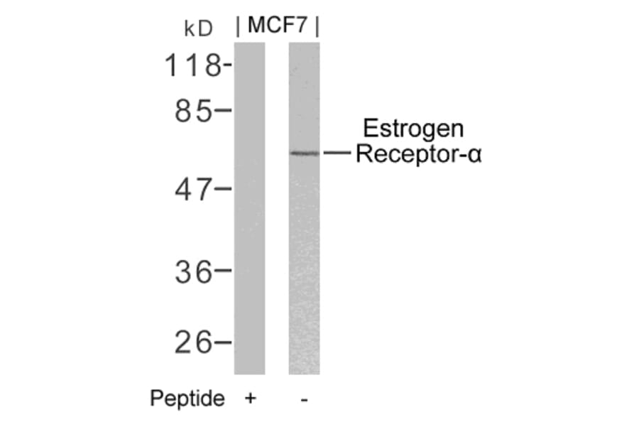 Western blot - Estrogen Receptor-a (Ab-106) Antibody from Signalway Antibody (21066) - Antibodies.com