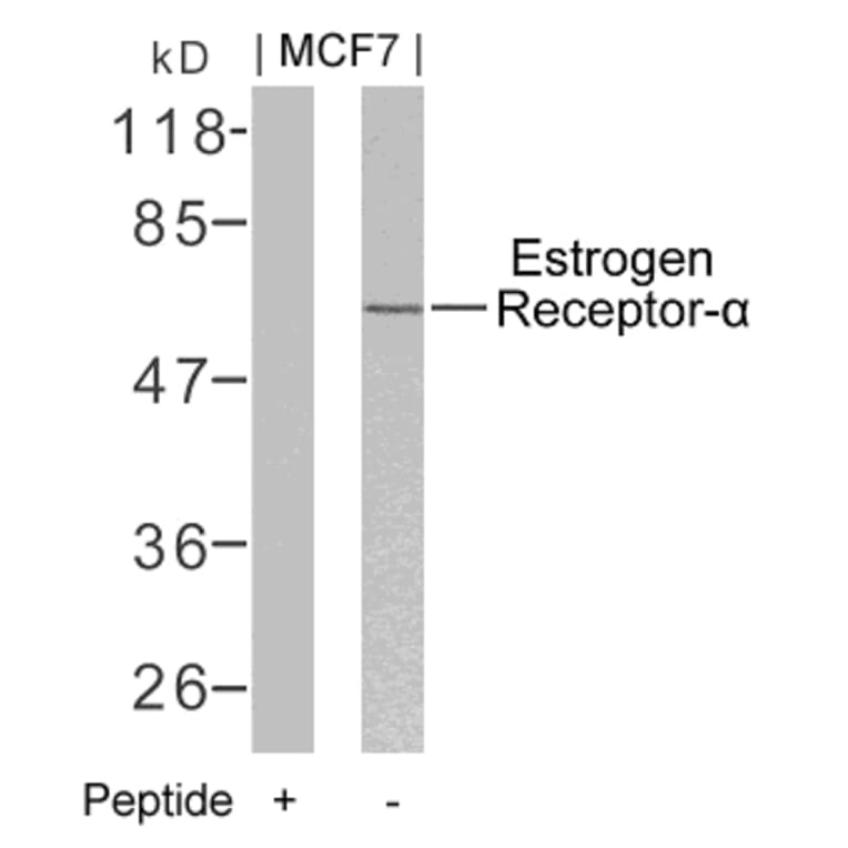 Western blot - Estrogen Receptor-a (Ab-106) Antibody from Signalway Antibody (21066) - Antibodies.com