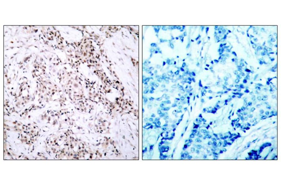 Immunohistochemistry - Estrogen Receptor-a (Ab-106) Antibody from Signalway Antibody (21066) - Antibodies.com