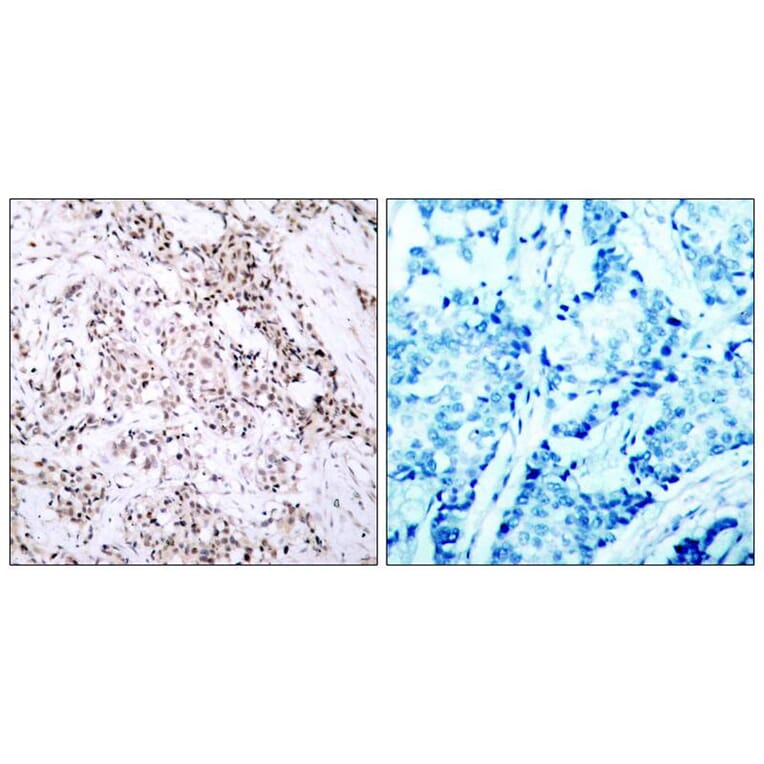 Immunohistochemistry - Estrogen Receptor-a (Ab-106) Antibody from Signalway Antibody (21066) - Antibodies.com