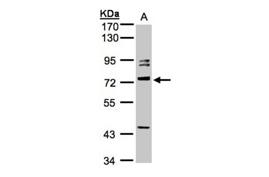 Amphiphysiniphysin isoform 1 antibody from Signalway Antibody (22441) - Antibodies.com