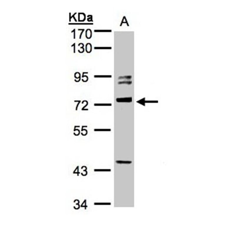 Amphiphysiniphysin isoform 1 antibody from Signalway Antibody (22441) - Antibodies.com