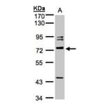 Amphiphysiniphysin isoform 1 antibody from Signalway Antibody (22441) - Antibodies.com