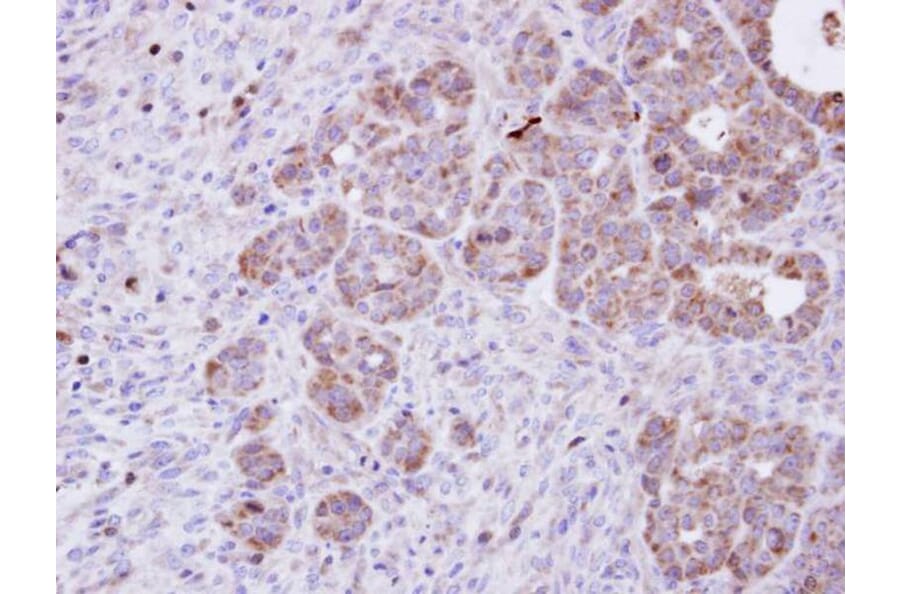 Immunohistochemistry - Amphiphysiniphysin isoform 1 antibody from Signalway Antibody (22441) - Antibodies.com