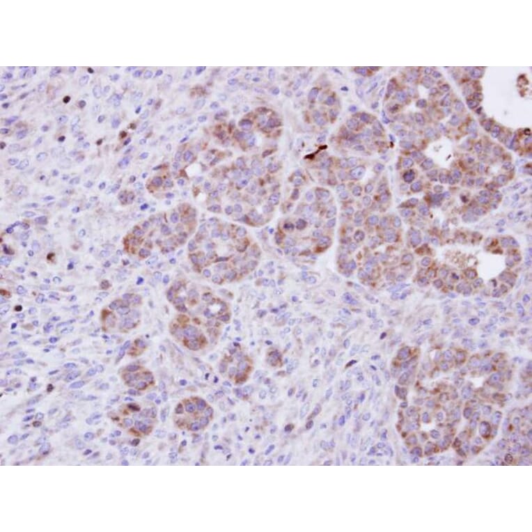 Immunohistochemistry - Amphiphysiniphysin isoform 1 antibody from Signalway Antibody (22441) - Antibodies.com