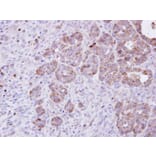Immunohistochemistry - Amphiphysiniphysin isoform 1 antibody from Signalway Antibody (22441) - Antibodies.com