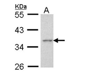 Apoptosis-enhancing nuclease antibody from Signalway Antibody (22725) - Antibodies.com
