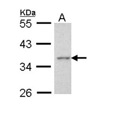 Apoptosis-enhancing nuclease antibody from Signalway Antibody (22725) - Antibodies.com