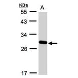 Yip1 domain family, member 4 antibody from Signalway Antibody (23158) - Antibodies.com