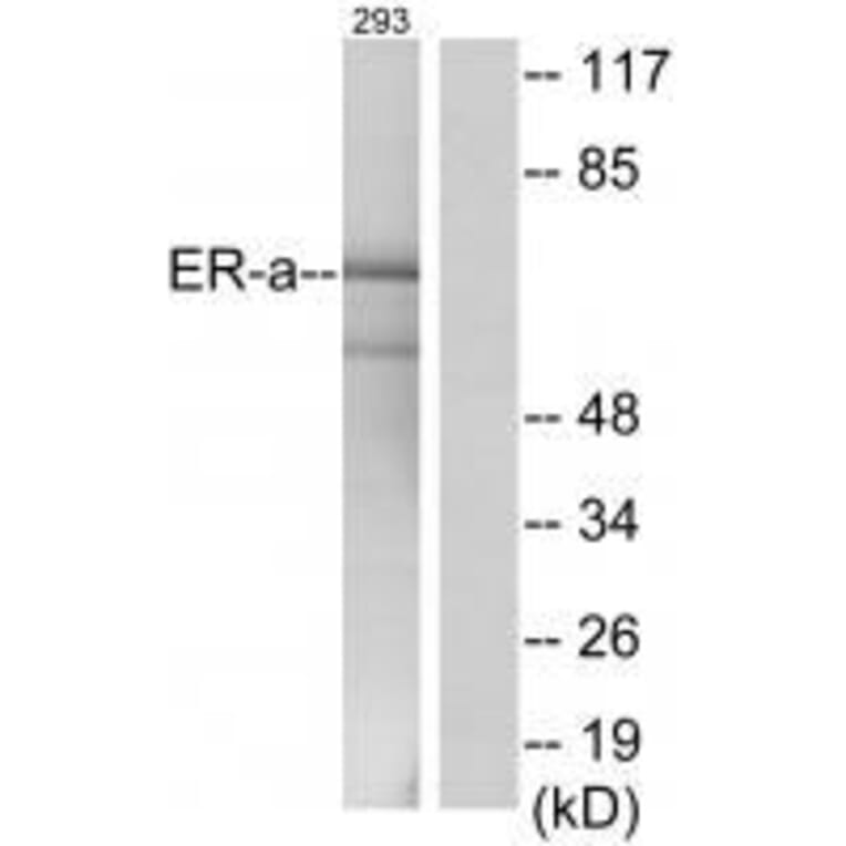 Western blot - Estrogen Receptor-α (Ab-537) Antibody from Signalway Antibody (33133) - Antibodies.com