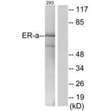 Western blot - Estrogen Receptor-α (Ab-537) Antibody from Signalway Antibody (33133) - Antibodies.com