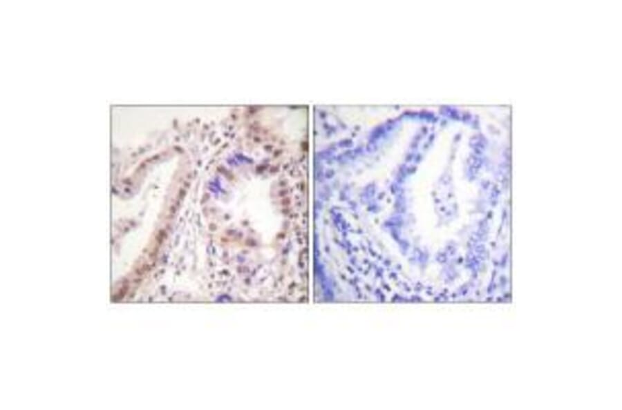 Immunohistochemistry - Estrogen Receptor-α (Ab-537) Antibody from Signalway Antibody (33133) - Antibodies.com