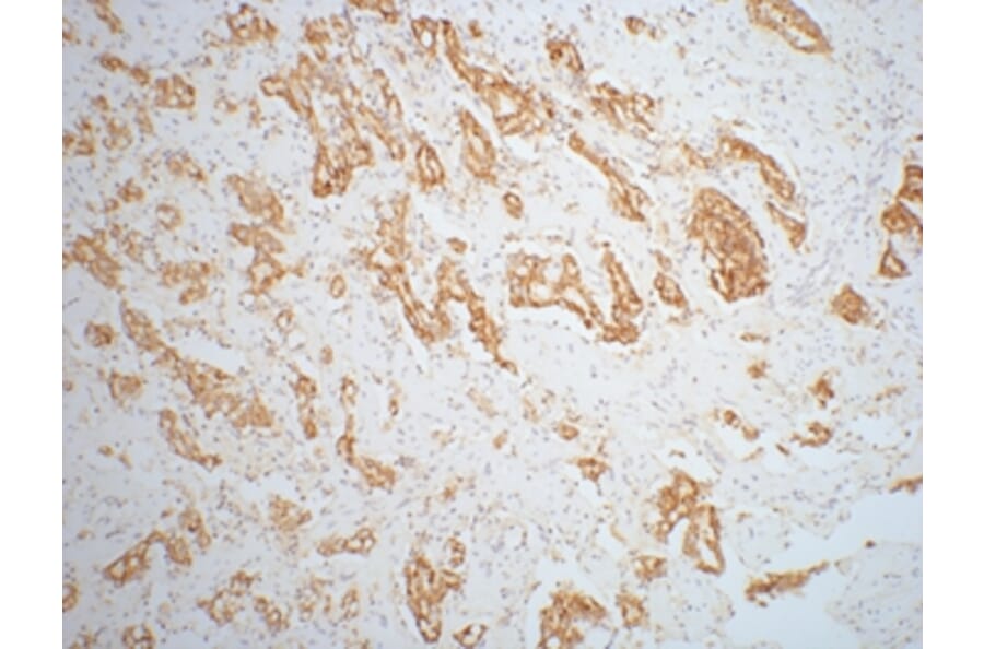 AMACR/P504S Mouse Monoclonal Antibody from Signalway Antibody (37999) - Antibodies.com